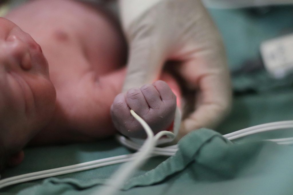 A newborn lies on a hospital bed while holding a caregiver’s gloved hand. The infant’s tiny hand grasps a medical tube, highlighting the delicate care provided in a clinical setting.